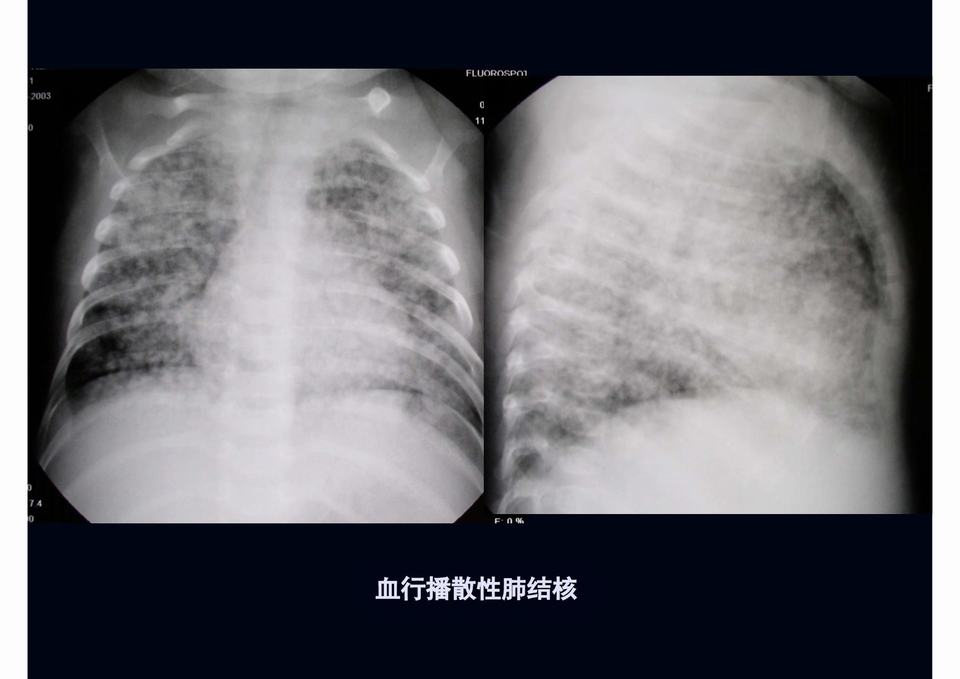 图23