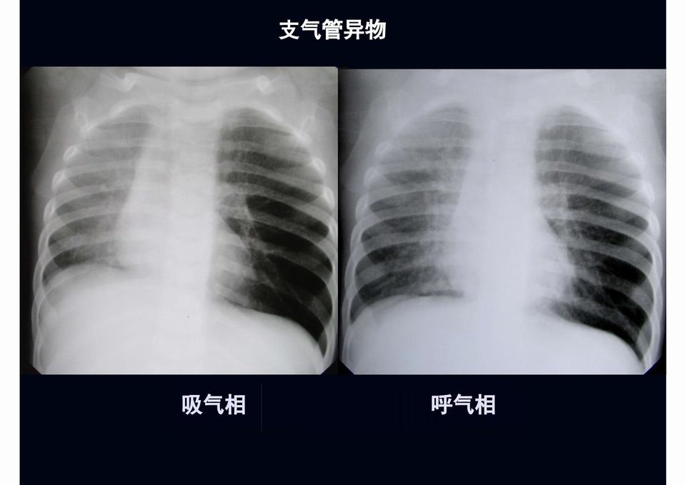 图26