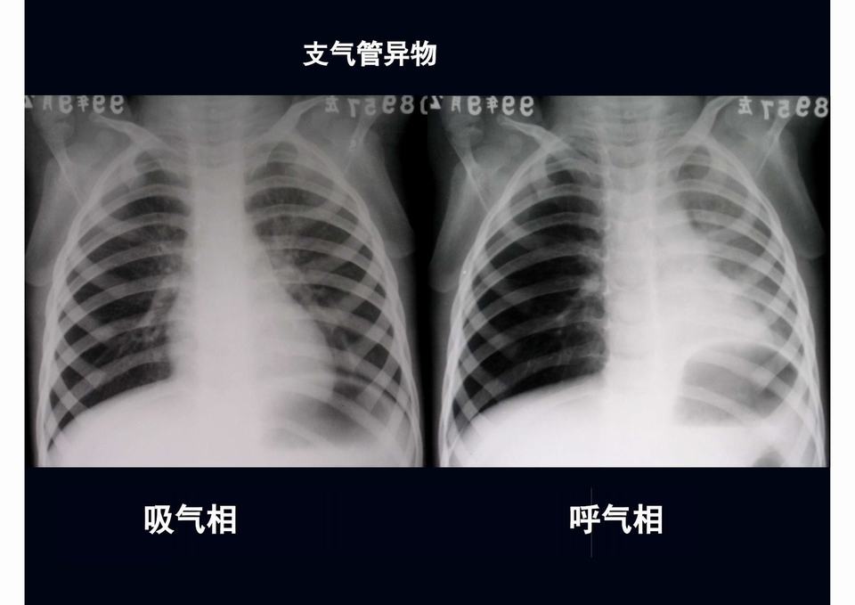 图27