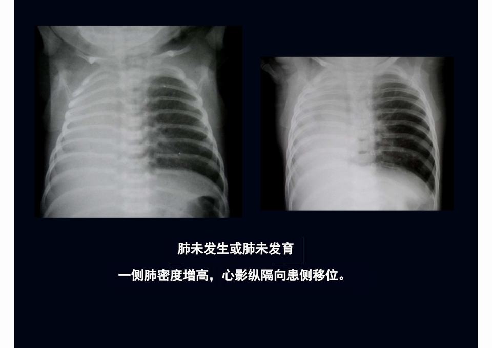 图31