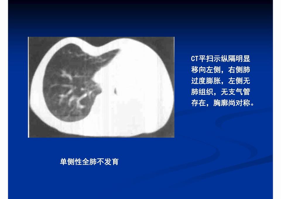 图32