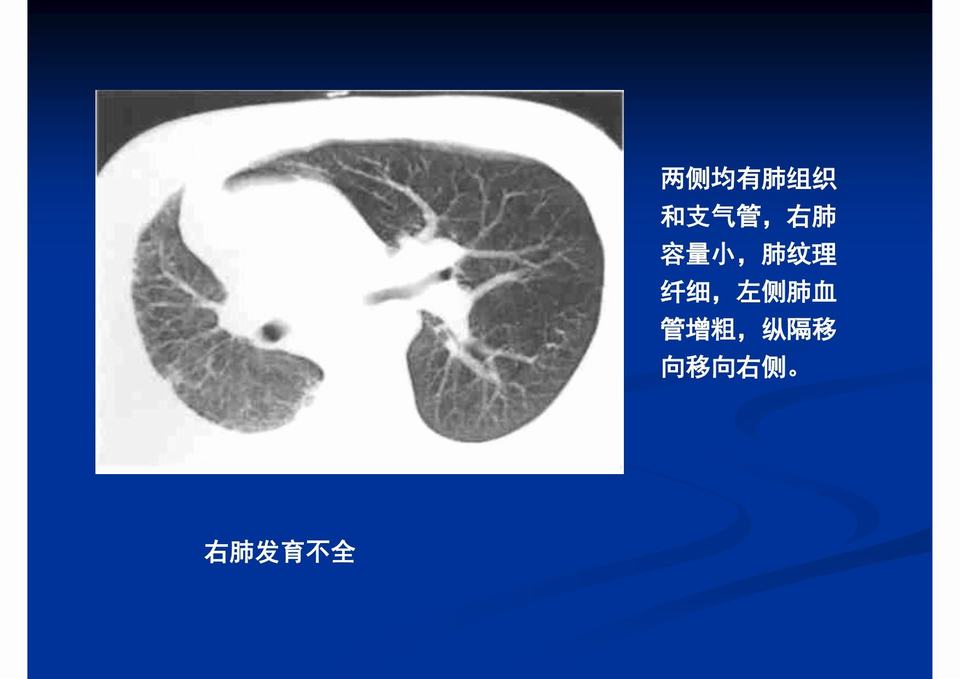 图33