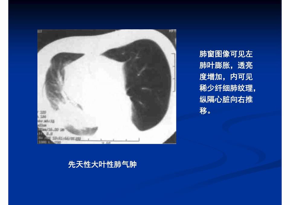 图34
