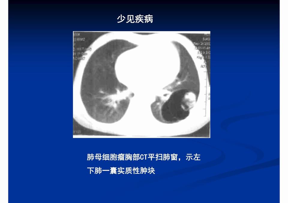 图37