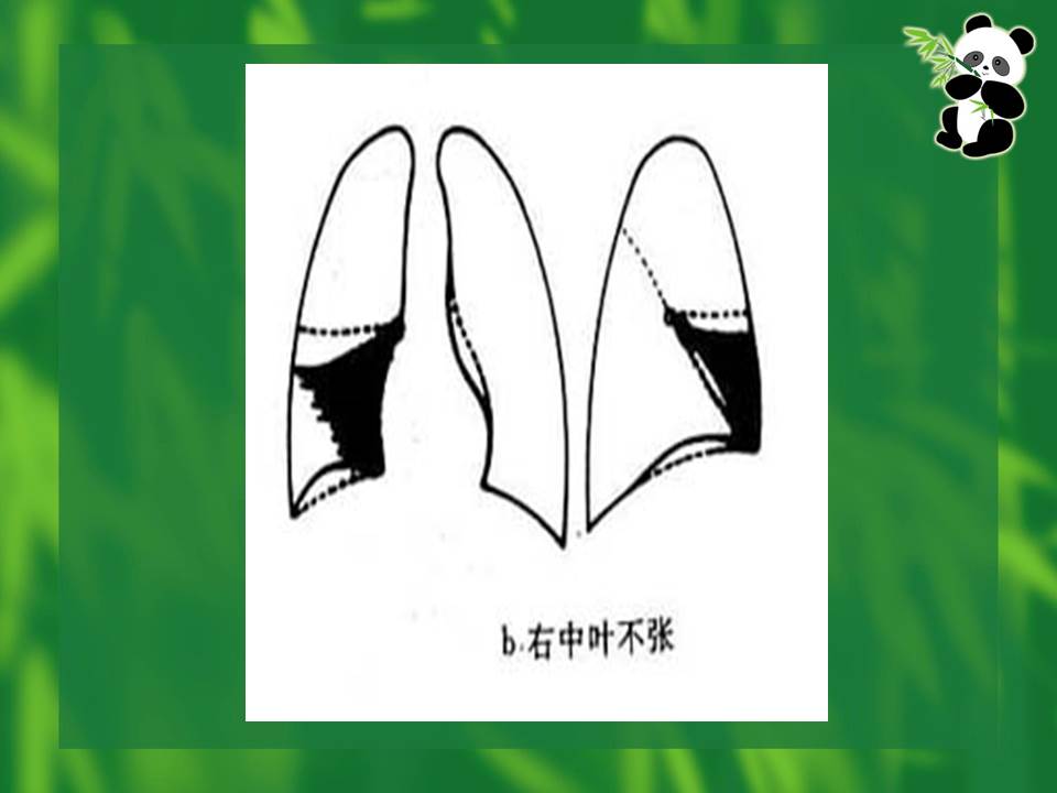 幻灯片18