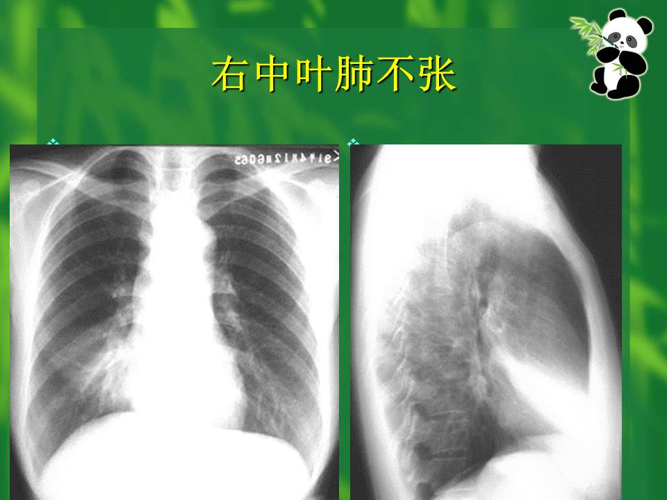 幻灯片19