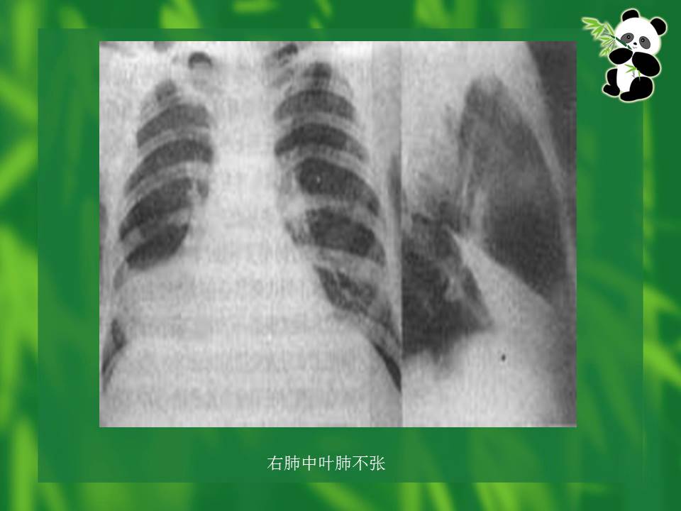 幻灯片20