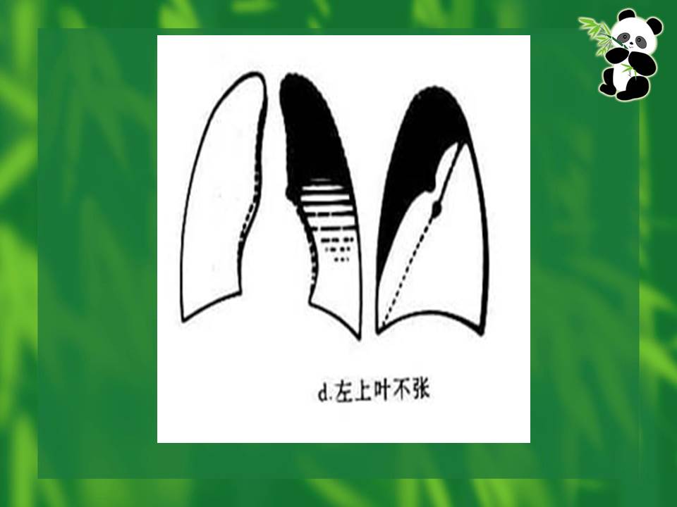幻灯片22