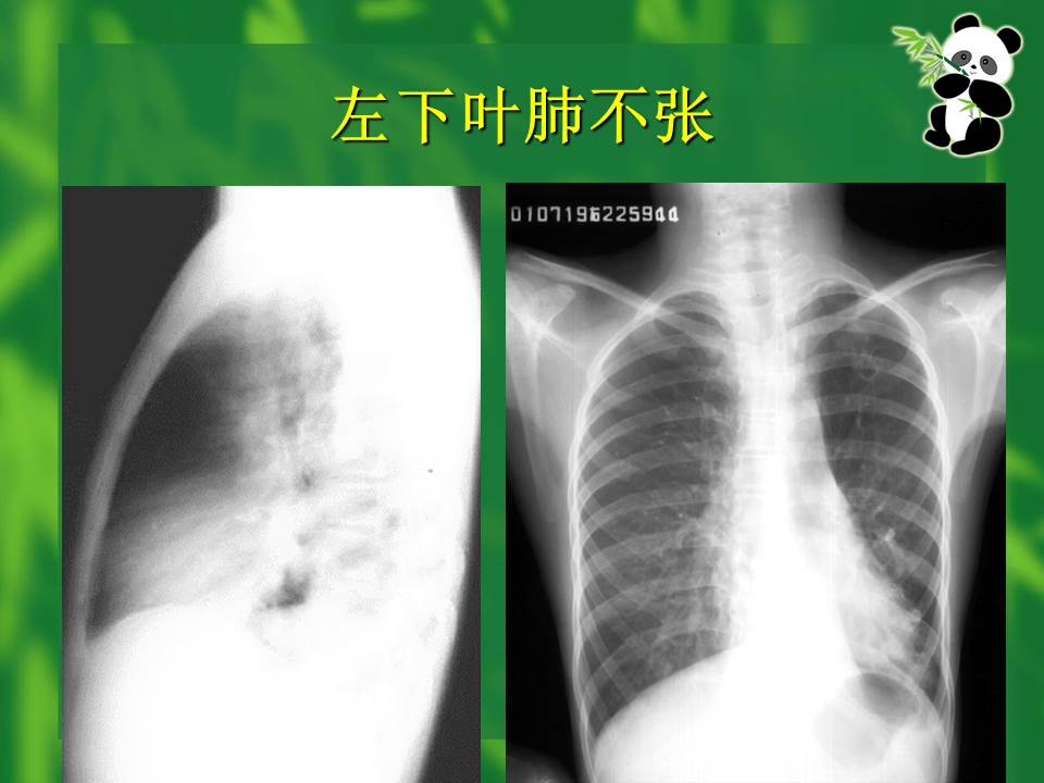 幻灯片23
