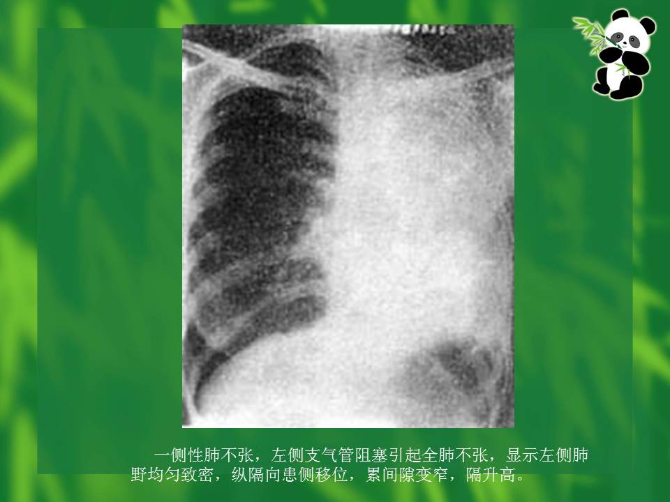 幻灯片25