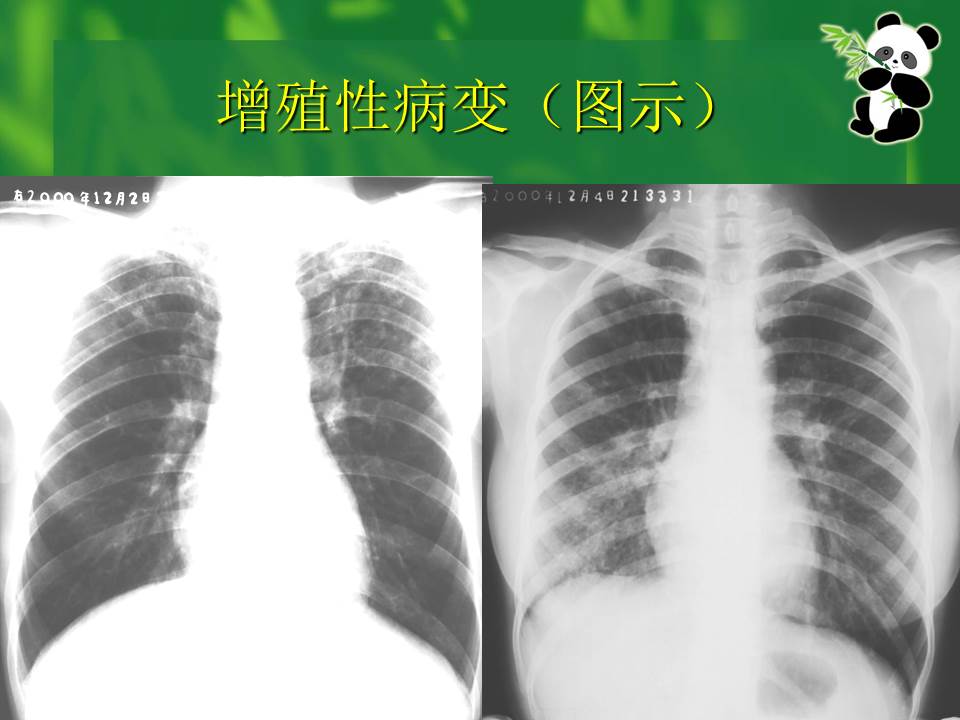 幻灯片31