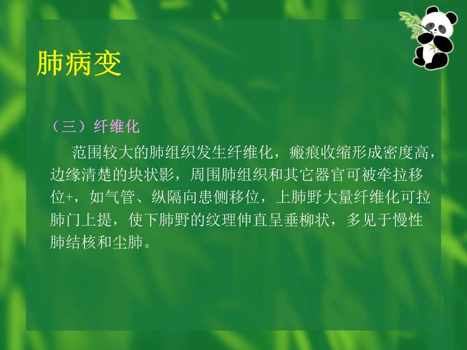幻灯片33