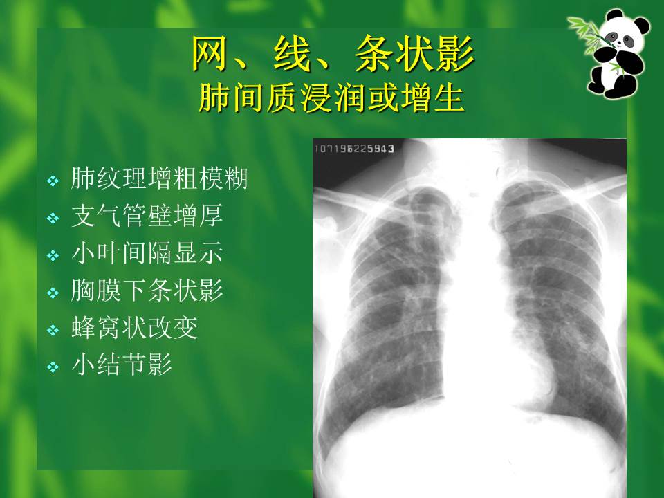 幻灯片36