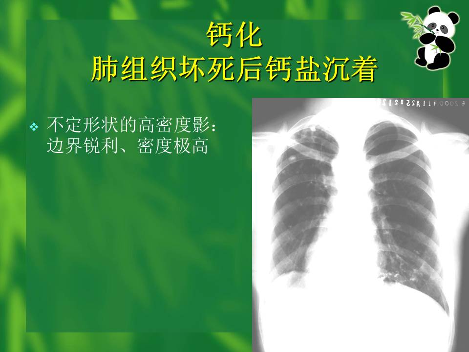 幻灯片38