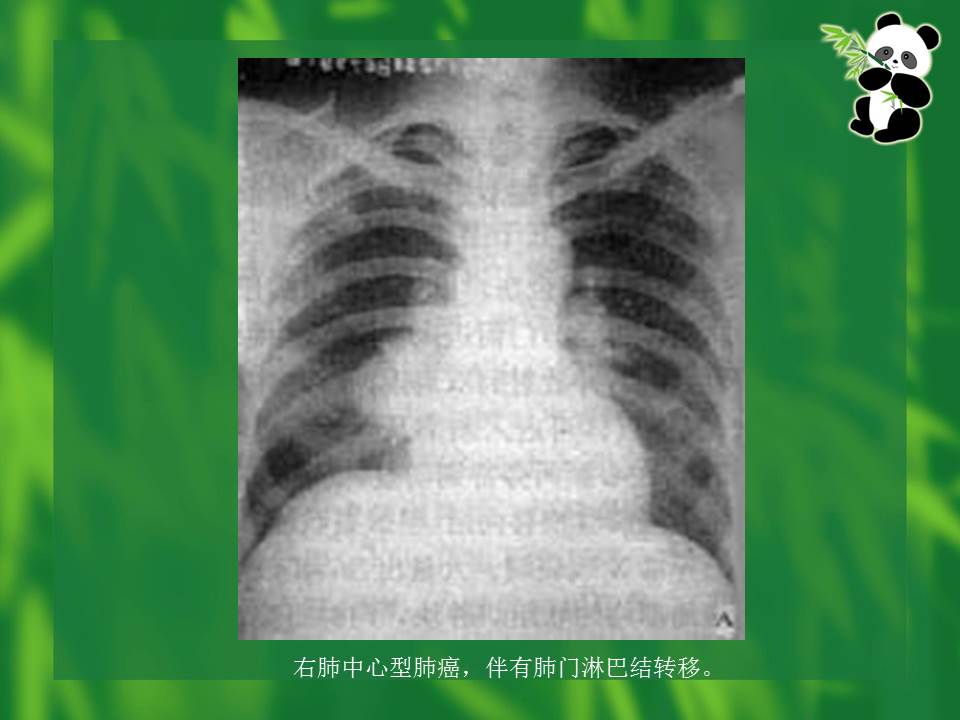 幻灯片43