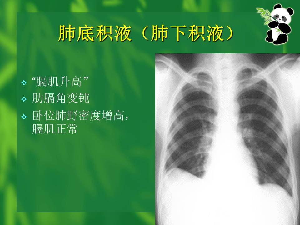 幻灯片63