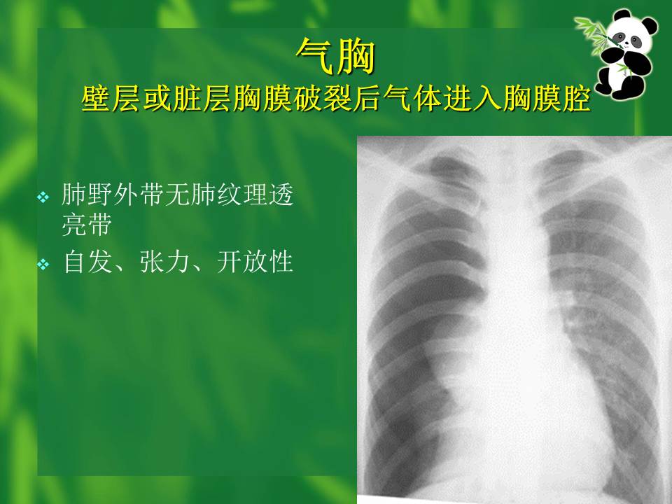 幻灯片70