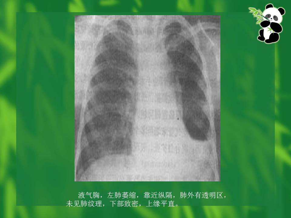 幻灯片71
