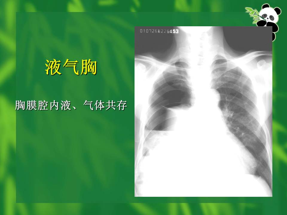 幻灯片72