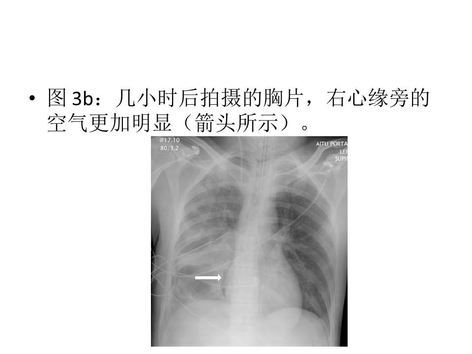 幻灯片9