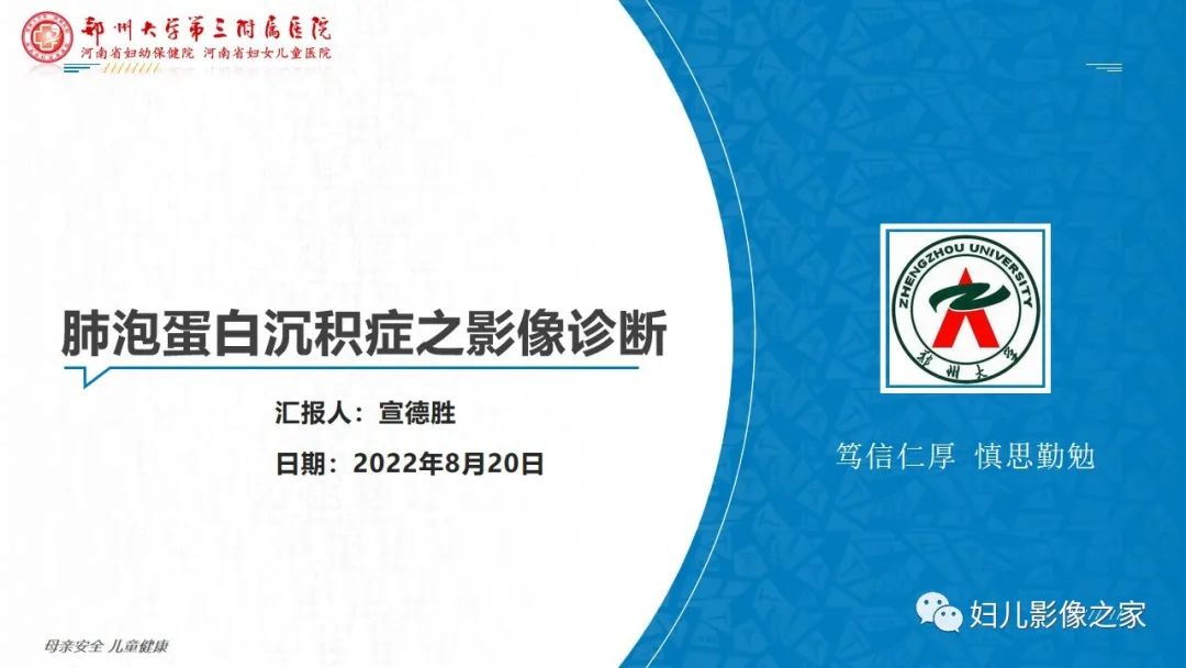 【PPT】肺泡蛋白沉积症的影像诊断