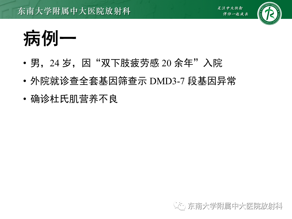 【PPT】心肌致密化不全