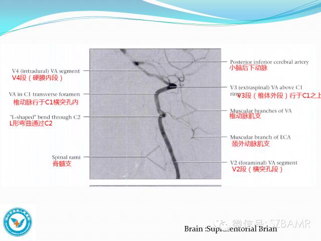 【PPT】椎-基底动脉系统解剖-20
