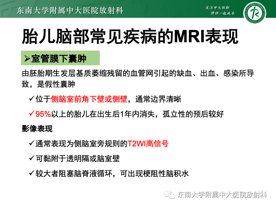 【PPT】胎儿颅脑MRI技术及常见神经系统发育异常-48