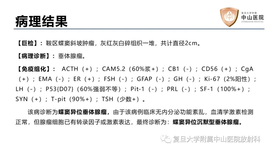 【病例】蝶窦异位垂体腺瘤1例CT及MR-12