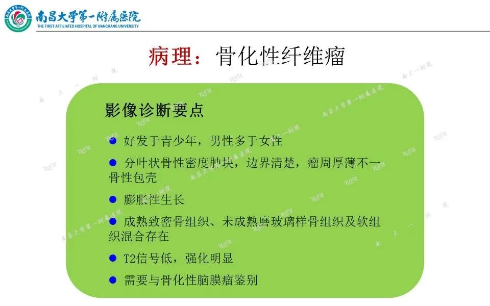 【PPT】颅底肿瘤的影像诊断思路-26