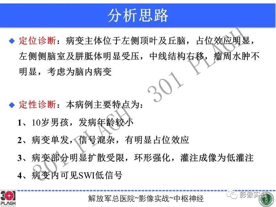 【病例】幕上室管膜瘤1例MR影像-20