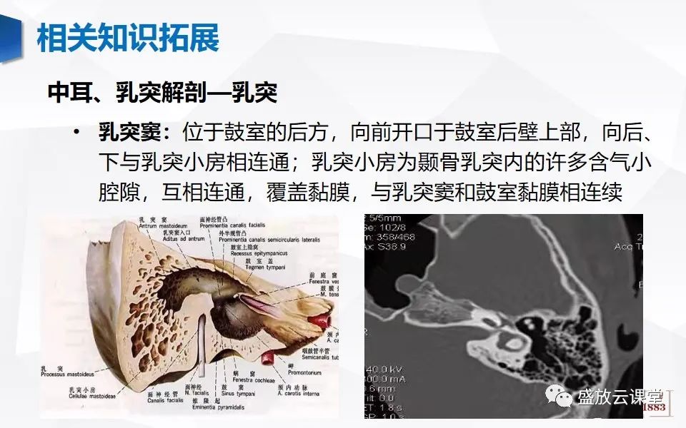 【PPT】中耳乳突解剖及炎症-33