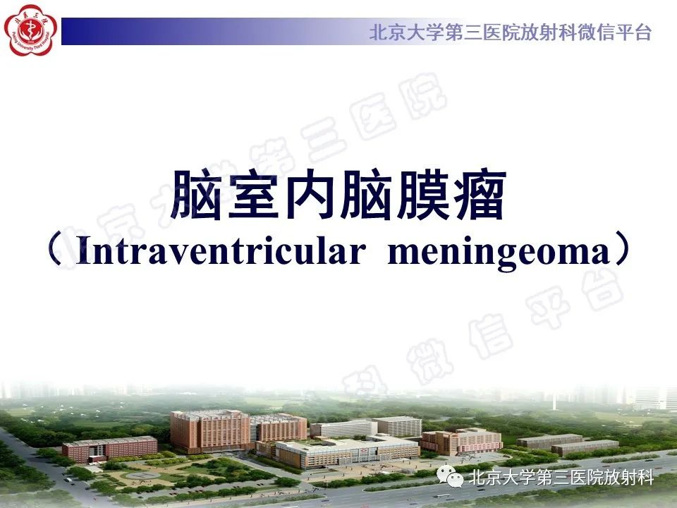 【PPT】脑室内脑膜瘤-9