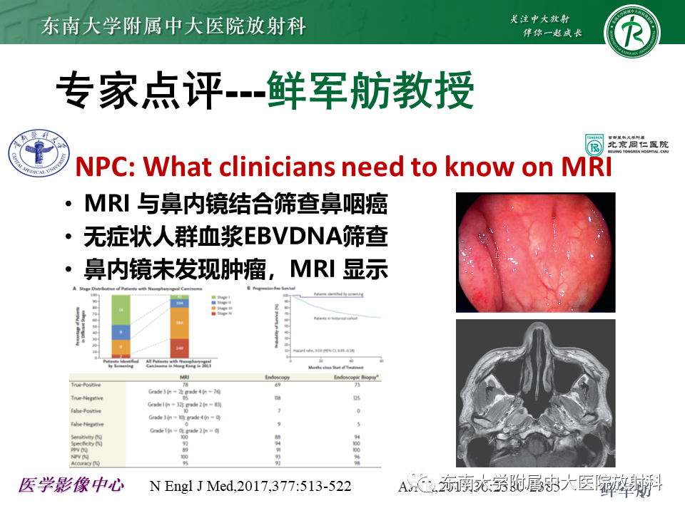 【PPT】鼻咽部占位性病变随访及鉴别-38
