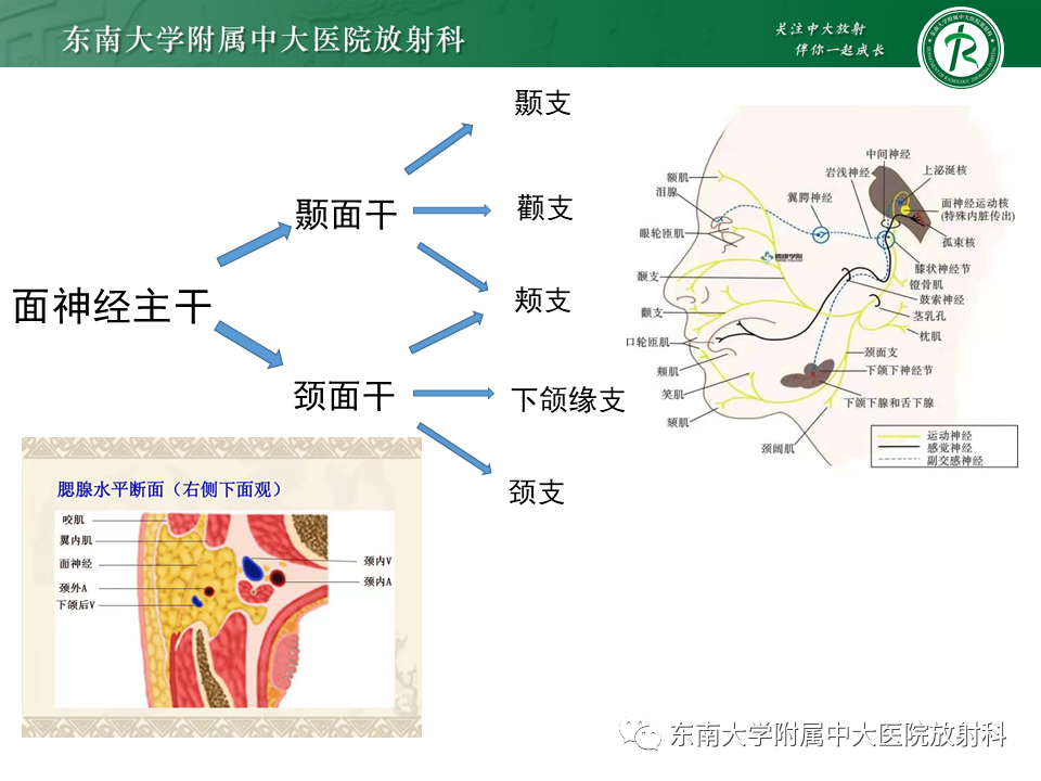 【PPT】面神经解剖及常见病影像学表现-19