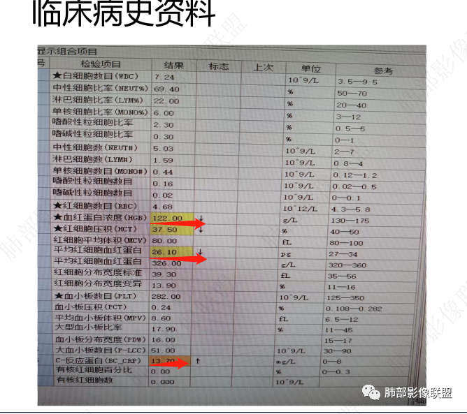 【病例】肺部这样的片状影，你是否能一锤定音？-13