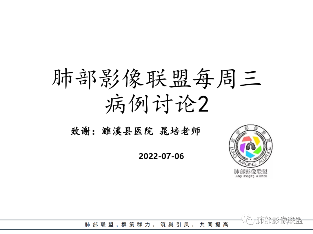 【病例】硬化性肺泡细胞瘤PSP一例CT