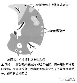 HRCT:磨玻璃影的意义