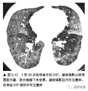 HRCT:磨玻璃影的意义