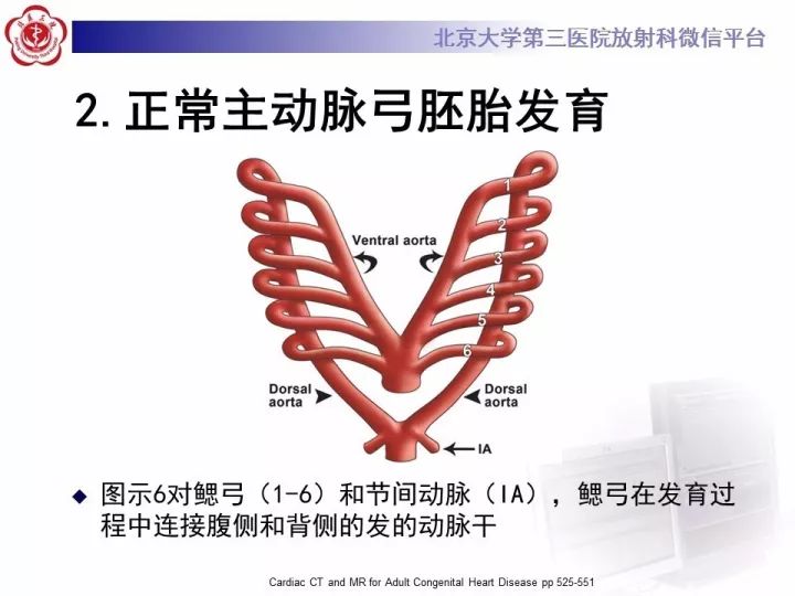 【病例】双主动脉弓畸形1例CT