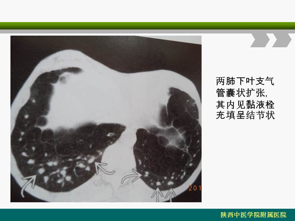 幻灯片12