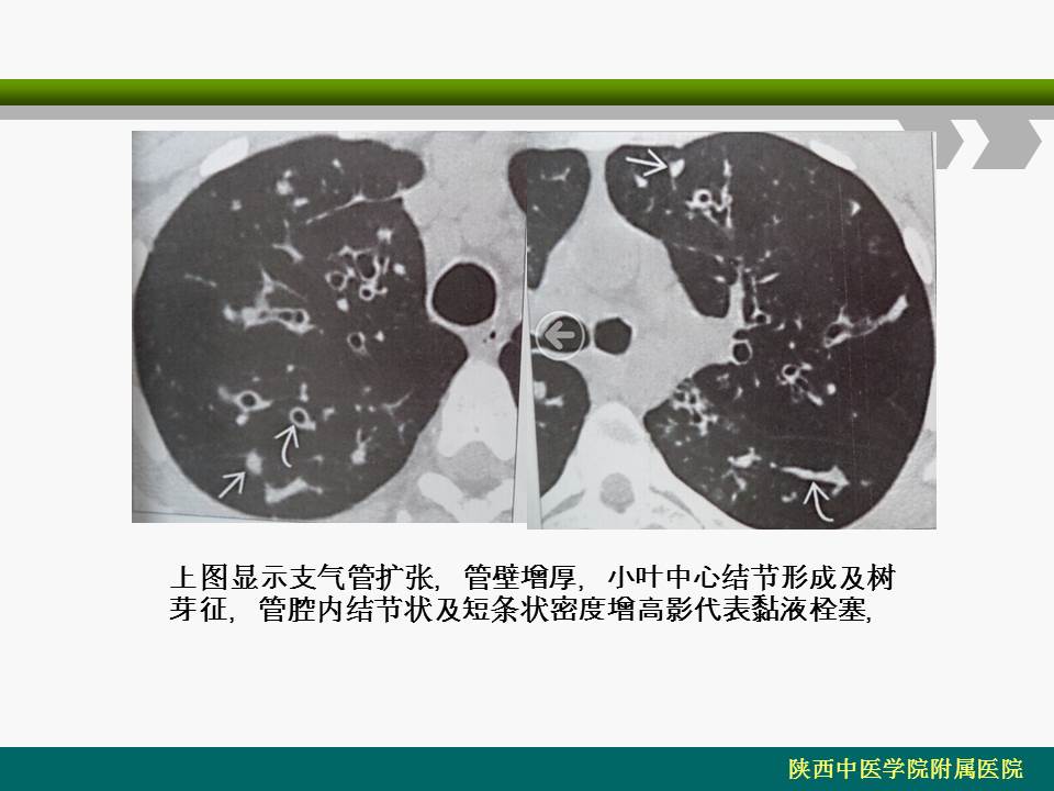 幻灯片19