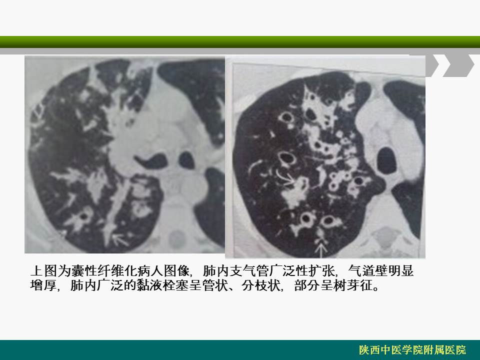 幻灯片20