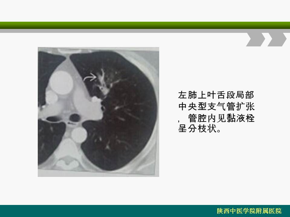 幻灯片22
