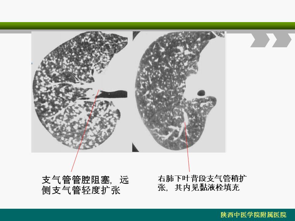 幻灯片26