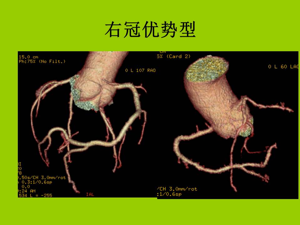 幻灯片20
