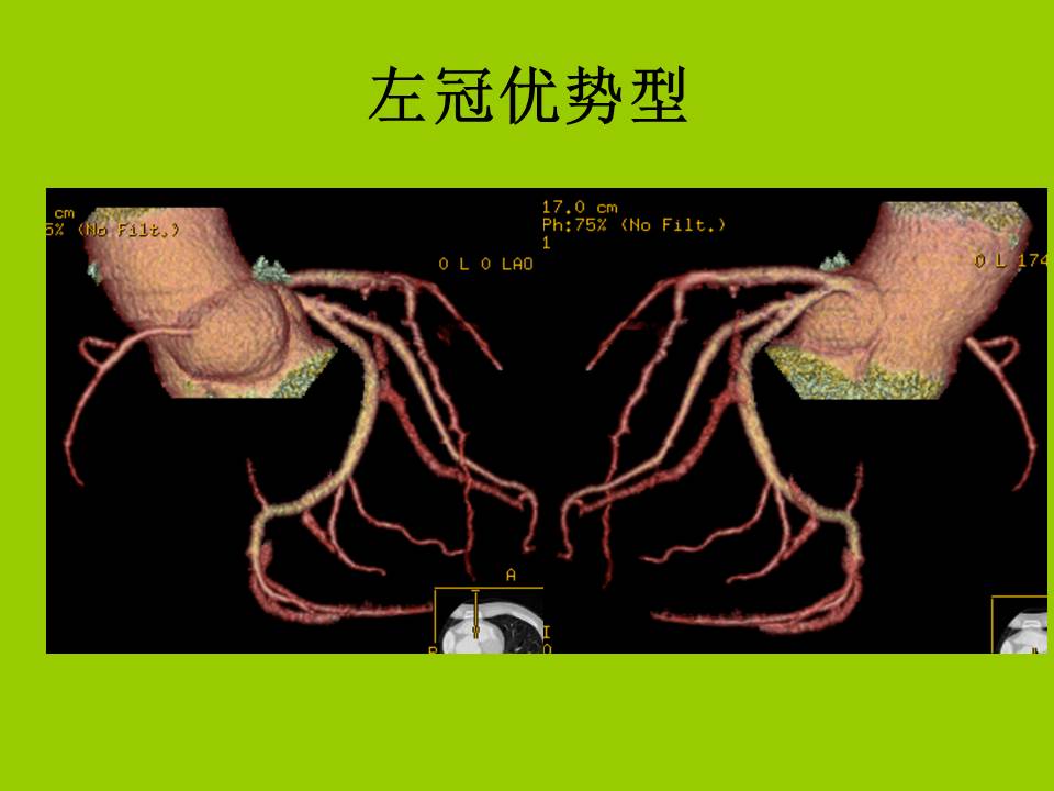 幻灯片21