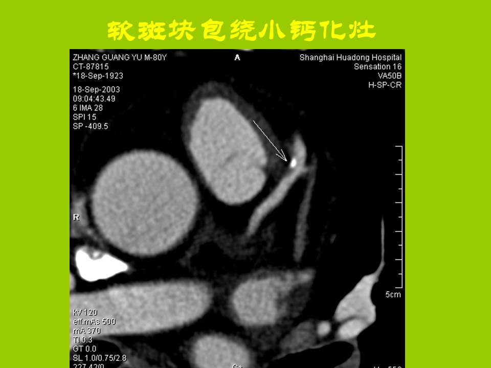 幻灯片30
