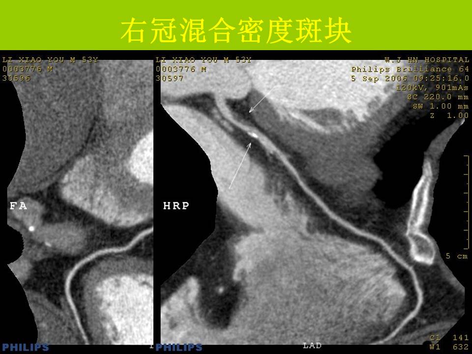 幻灯片31