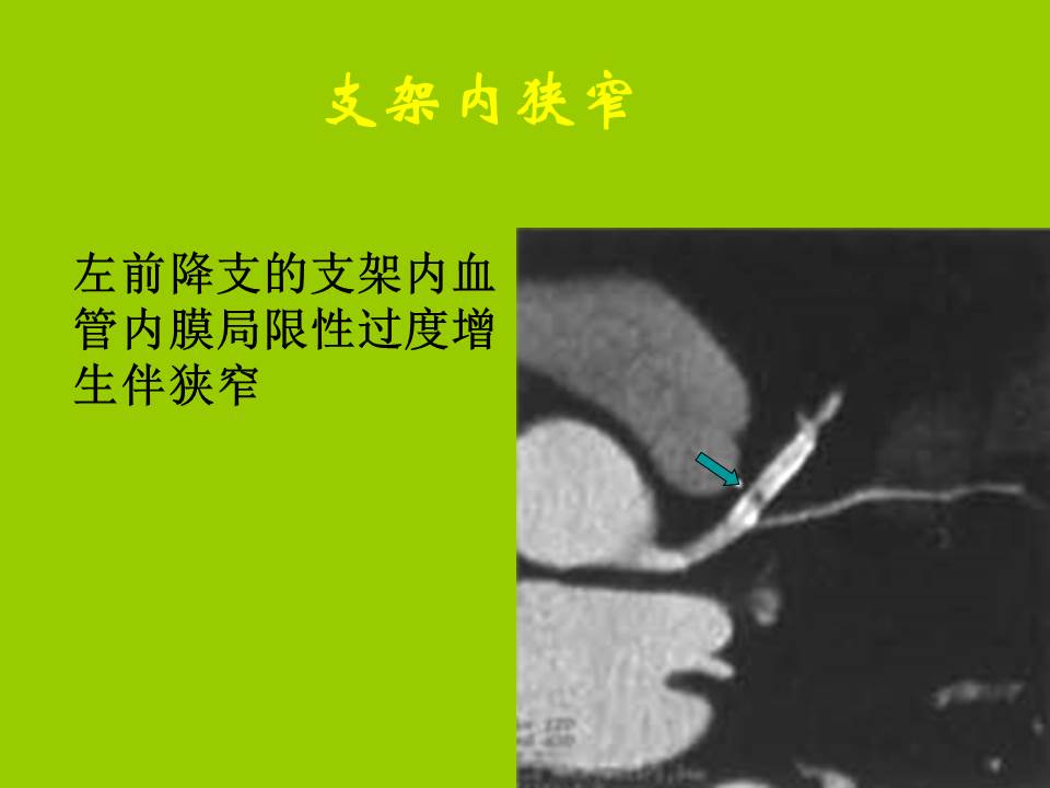幻灯片53